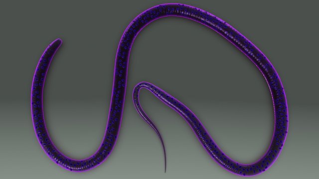 Wuchereria bancrofti 