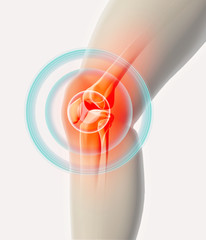 Knee painful - skeleton x-ray.