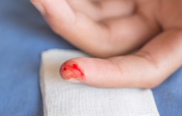 Ulcers on fingers