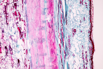 Background of bordered pit cell under the microscope.