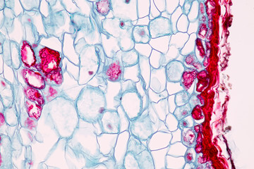 Background of bordered pit cell under the microscope.