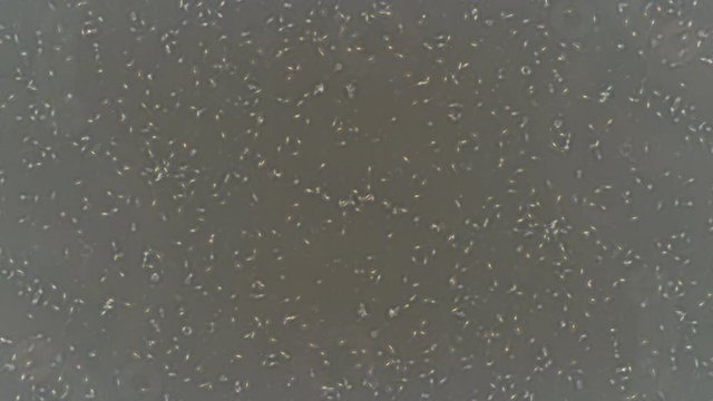 Healthy human sperm under microscope