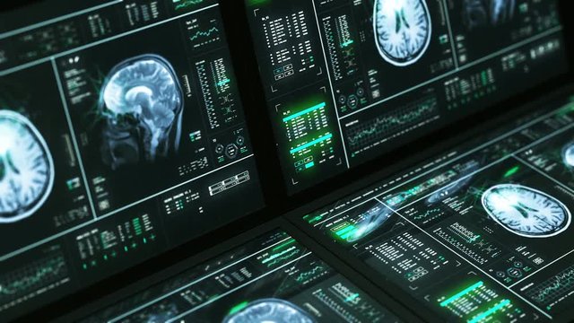 MRI Brain Scan Analysis Monitors