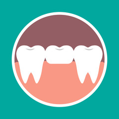 Vector illustration icon dental bridge. Orthodontics, dental implants, orthopedics.