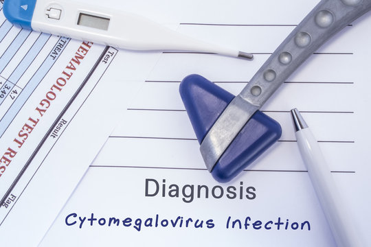 Diagnosis Cytomegalovirus Infection. Paper medical report written with neurological diagnosis of Cytomegalovirus Infection is surrounded by neurological reflex hammer, thermometer and blood test