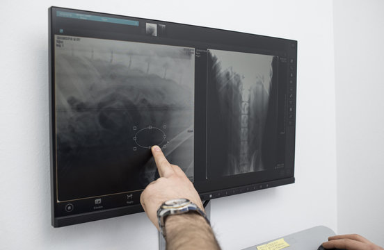 Vet doctor pointing at x-ray