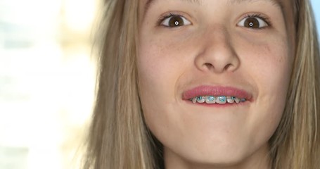 Girl with braces - Powered by Adobe