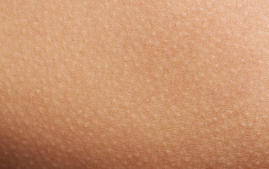Goose bumps on human skin