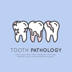 Isolated Vector Style Illustration Logo Badge or Dental Tooth Pathology and Decay, Dental Caries, Tooth Crack and Calculus