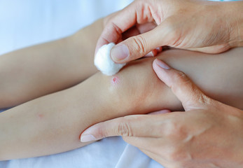 Close up wound on child knee. Mother dressing child's knee.