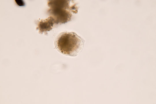 Protozoa in water under microscope view.