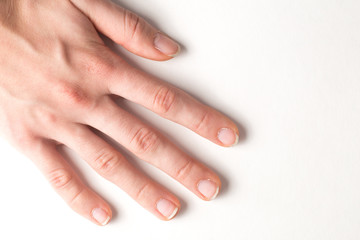 Female hand with manicure ugly
