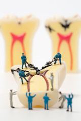 People to clean tooth model on white background,miniature