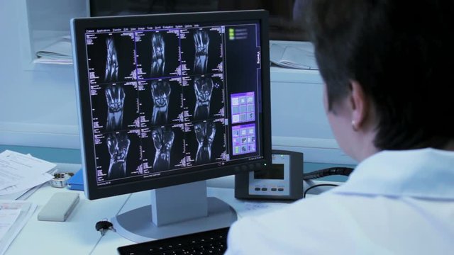 Woman doctor in a hospital explorers of x-ray images on the monitor close-up