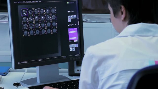 The doctor examines the brain images on a computer
