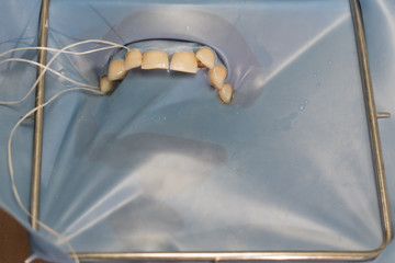 La pista del dentista
