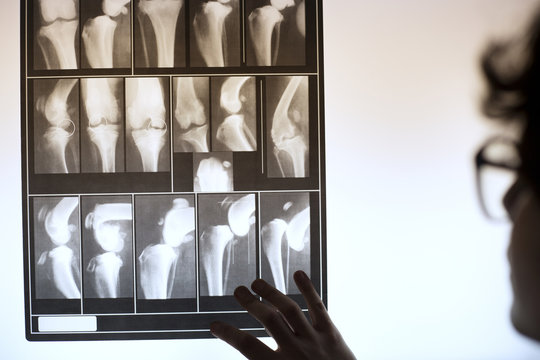 Cropped image of vet examining x-ray image in clinic