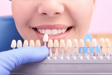 Dentist checking and selecting color of young woman's teeth, closeup