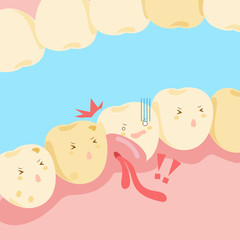 cartoon tooth with gingival swelling