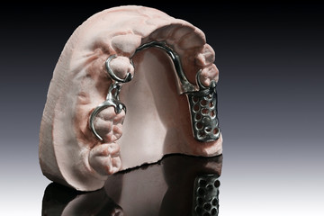 removeable partial denture plate