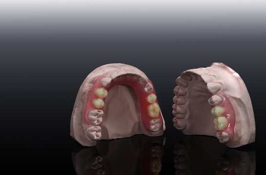 two tempolaryplate denture