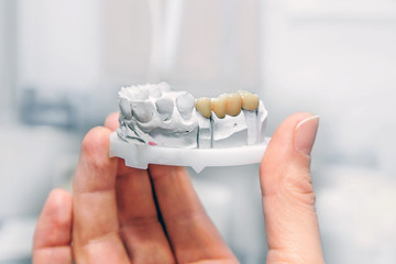 Technical shots on a dental prothetic laboratory