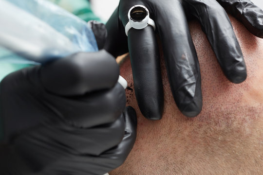 Cosmetologist making permanent makeup on man head - tricopigmentation
