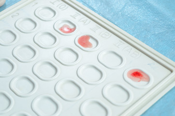 Blood group and rh factor testing