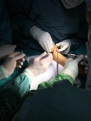 hand surgery in surgery room