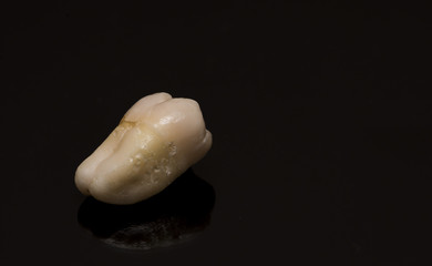 human tooth close-up