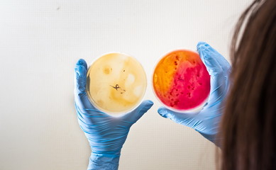 Laboratory technician testing for bacterial infection. Lab worker analyzes test samples in Petri dishes. Bacterial colonies growth. Medical hospital laboratory research. Hands holding test samples