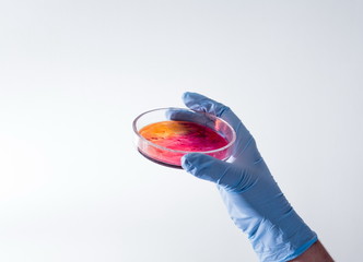Laboratory technician testing for bacterial infection. Lab worker analyzes test samples in Petri dishes. Bacterial colonies growth. Medical hospital laboratory research. Hands holding test samples.