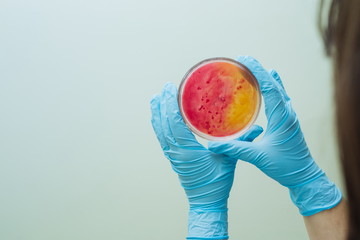 Laboratory technician testing for bacterial infection. Lab worker analyzes test samples in Petri...