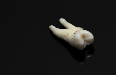 human tooth close-up