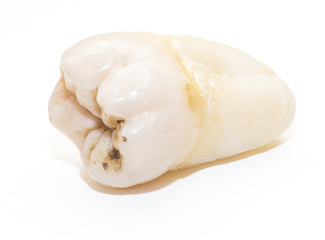 human tooth close-up