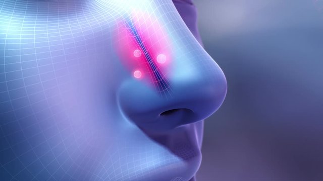 Rhinitis Demo. Two high quality medical animations. A man with a head cold, the flu, or allergies blowing his nose.