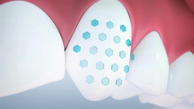 Teeth cleaning. High quality animation 3D showing the process of teeth cleaning.