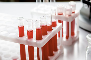 Medical equipment blood test in laboratory no one