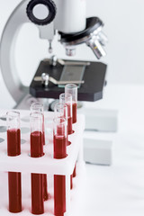 blood in glass tubes on background of microscope