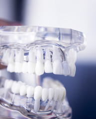 Dentists dental teeth model