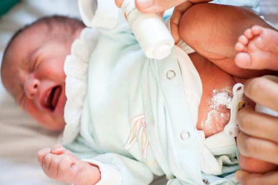 Newborn baby belly-button