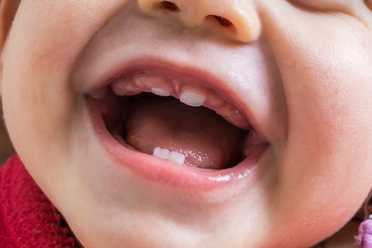 Closeup view on open mouth of baby. First teeth growing.