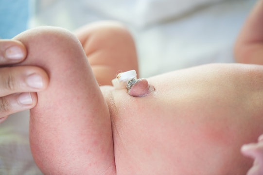 Newborn baby belly-button