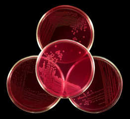 Biohazard / biosafety sign composed by glass petri plates with red agar Endo. Colonies of Escherichia coli enteric intestinal bacteria. Isolation by pen.