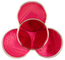 Sign Biosafety / biohazard composed by red agar Endo petri plates. Colonies of Escherichia coli intestinal bacteria are on agar surface. Isolation by pen.