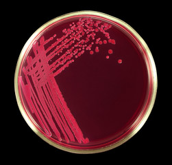 Lactose - negative Escherichia coli bacteria microbe on the red agar Endo. Close-up. Isolation by pen.
