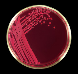Lactose - negative Escherichia coli bacteria microbe on the red agar Endo. Close-up. Isolation by...