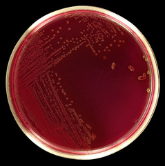 Lactose - positive Escherichia coli bacteria on red agar Endo. Isolation by pen. Picture is made on black background.