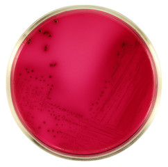 Lactose - positive Escherichia coli bacteria on red agar Endo. Close-up. Isolation by pen.
