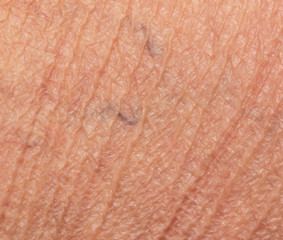 Fototapeta premium varicose veins on the skin as a background